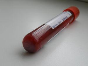 Analítica de sangre en niños: ¿en qué consiste?