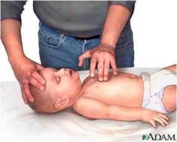 Reanimación cardiopulmonar (RCP) en bebés y niños. ¿Cómo se realiza?