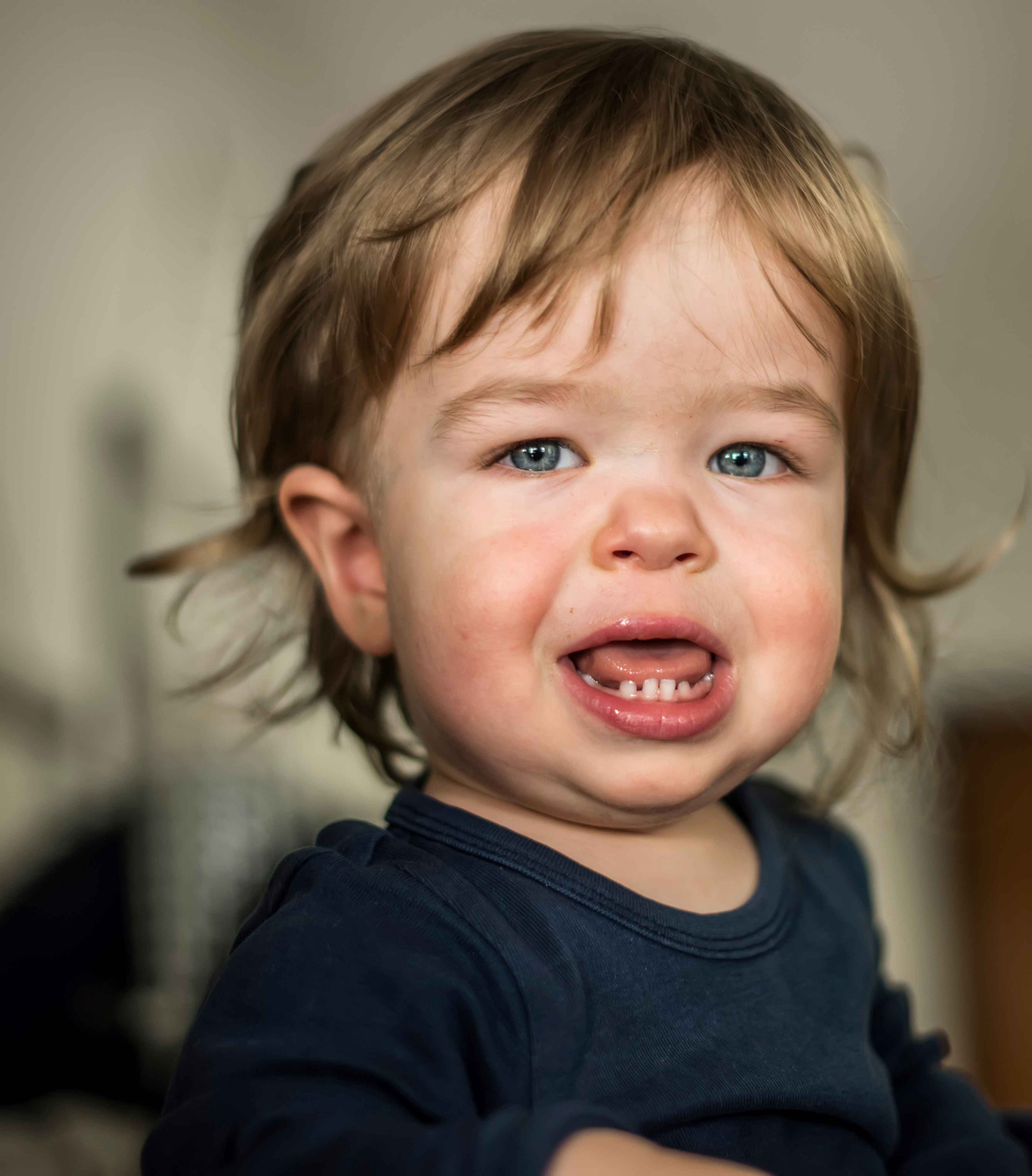 Retrato de niño con acondroplasia
