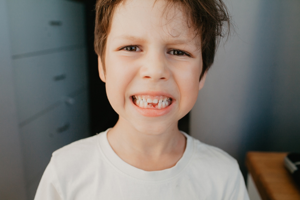 Traumatismes dentals: com actuar quan un nen pateix un cop a una dent