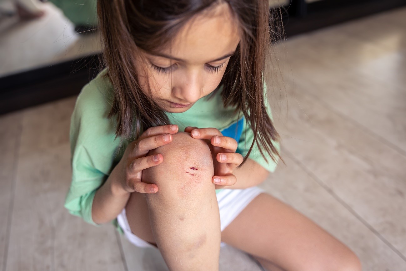 Nena amb ferida al genoll