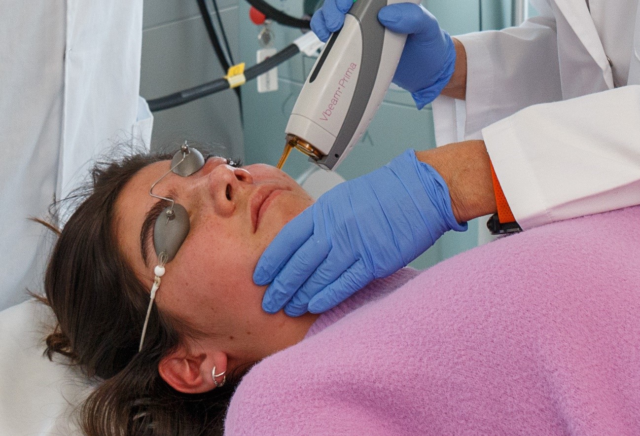 Chica recibiendo tratamiento con láser colorante pulsado en el Hospital Sant Joan de Déu