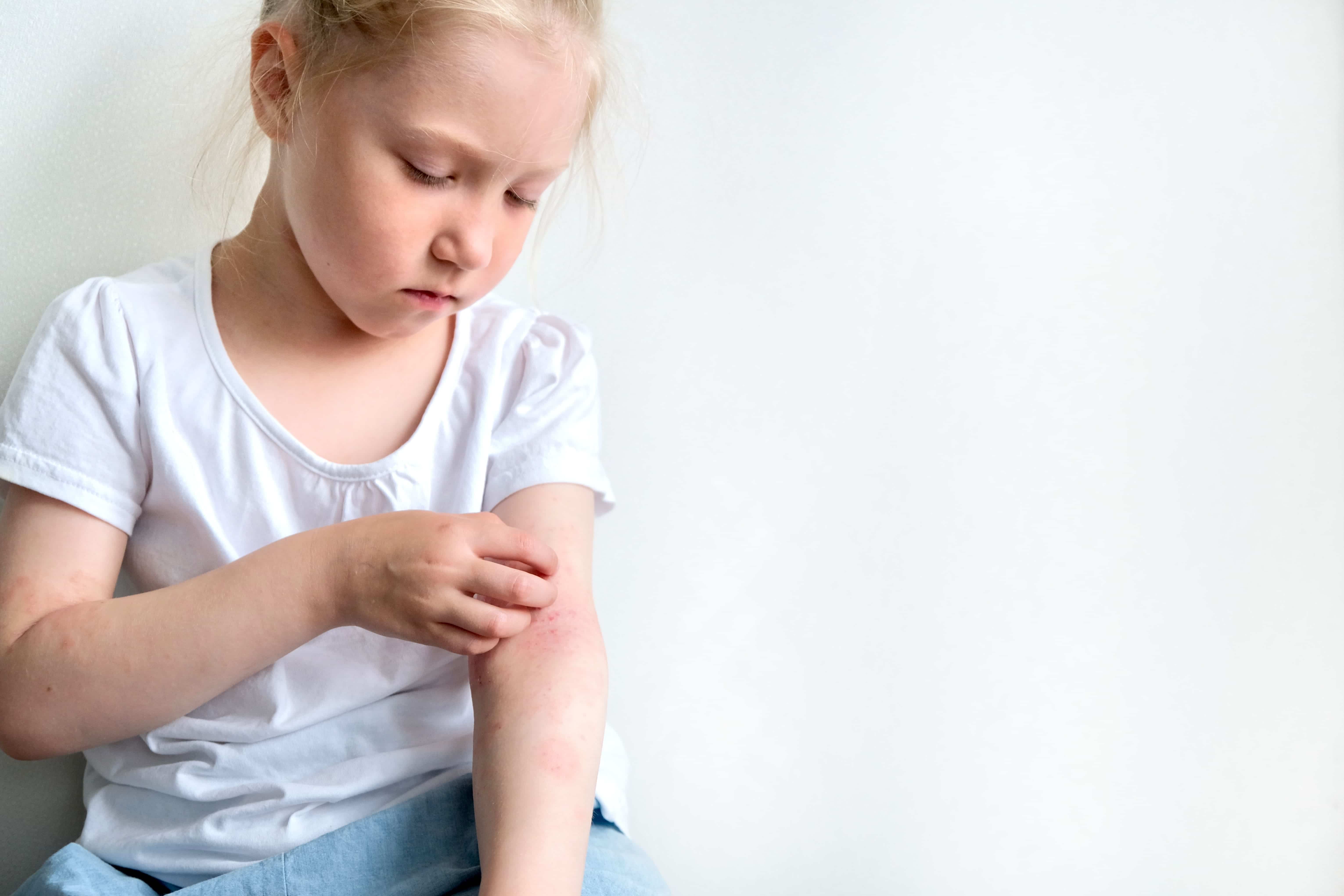 Niña con picor en el brazo 