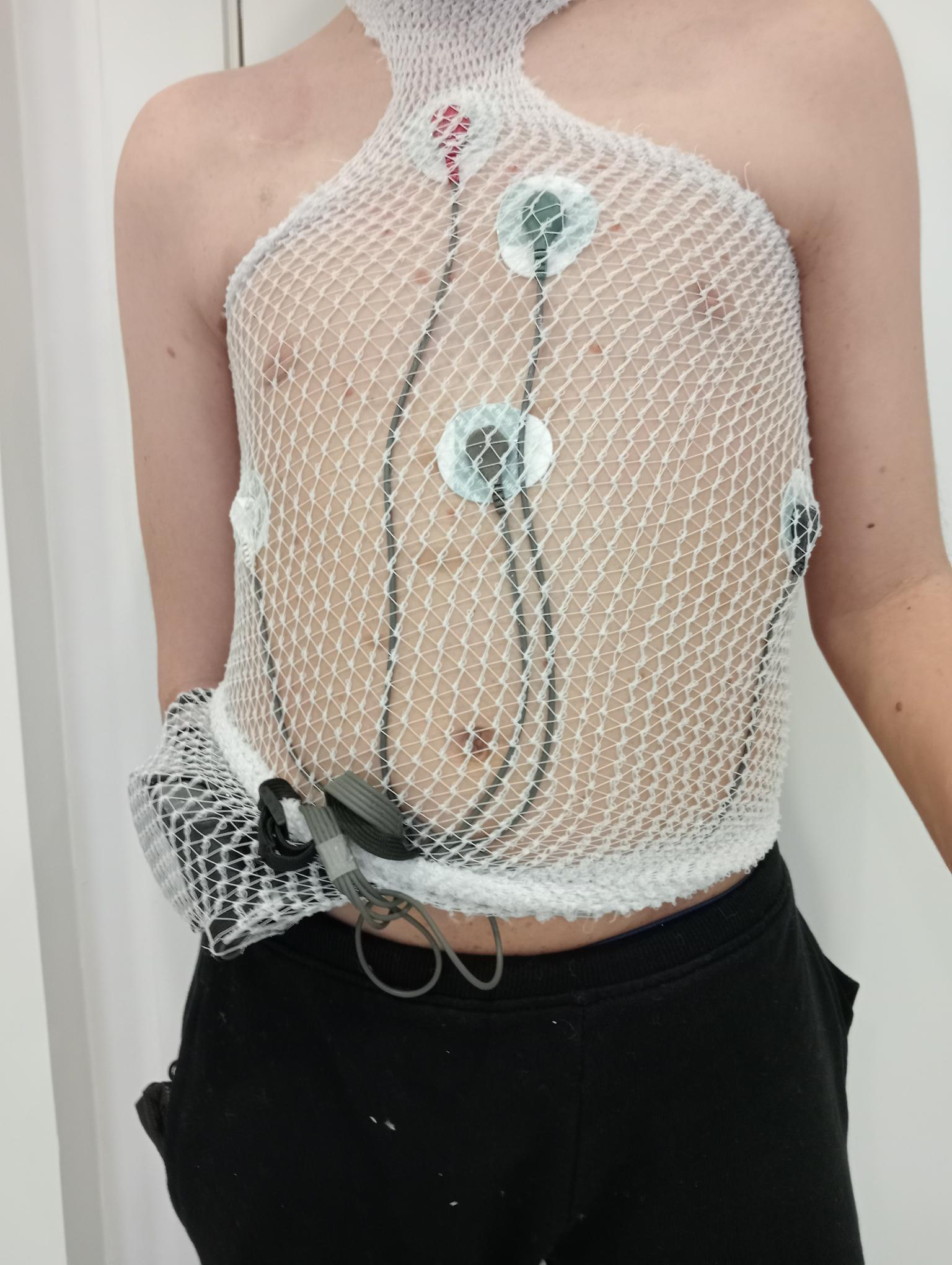 Holter cardíac de 24 hores