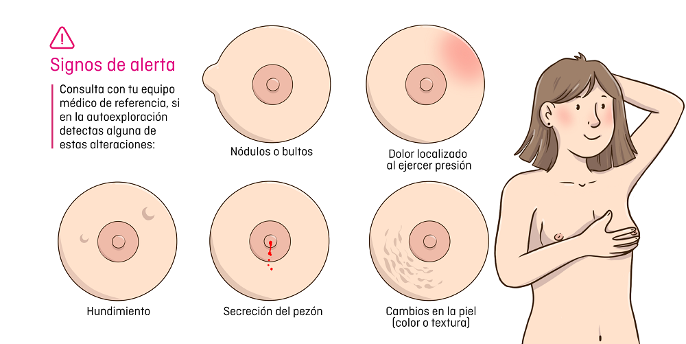 signos de alerta en la autoexploración mamaria