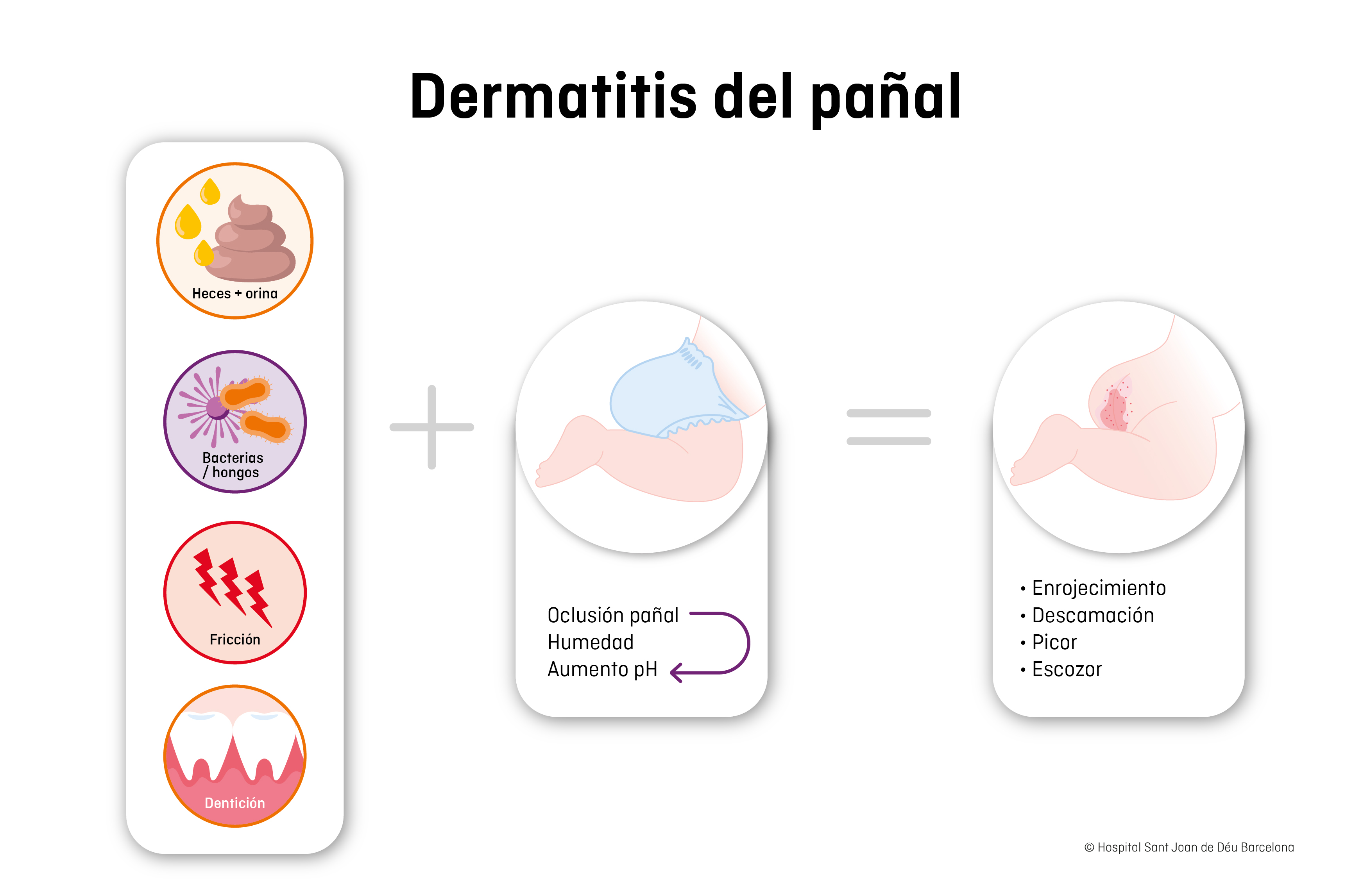 Dermatitis de pañal