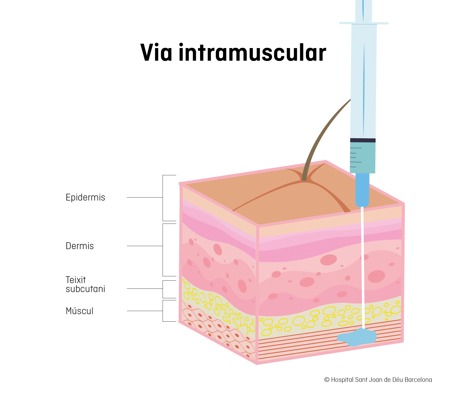 Ilustración vía intramuscular