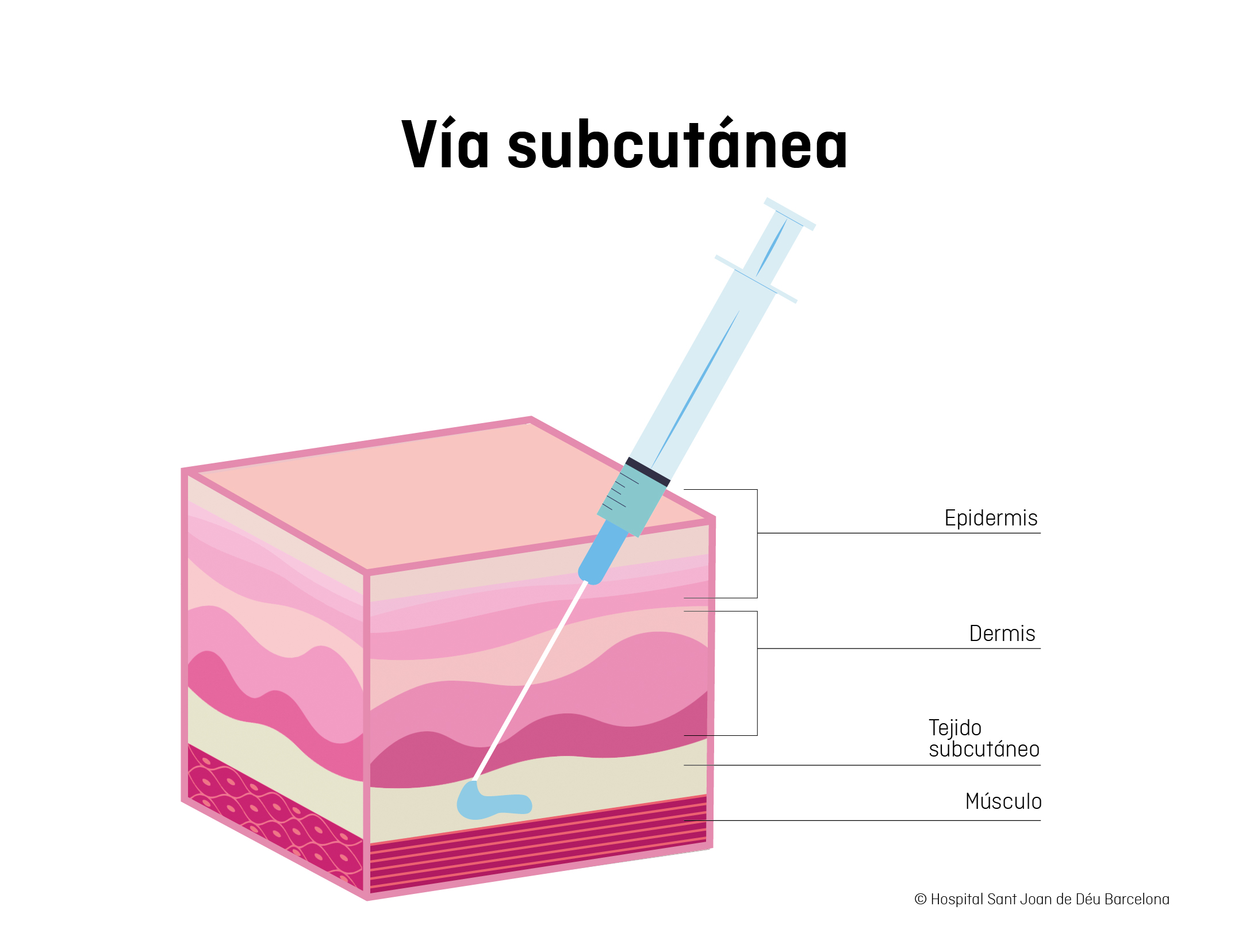 Vía subcutánea